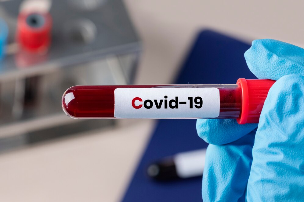 A Pandemia e Seu Impacto na Política Global