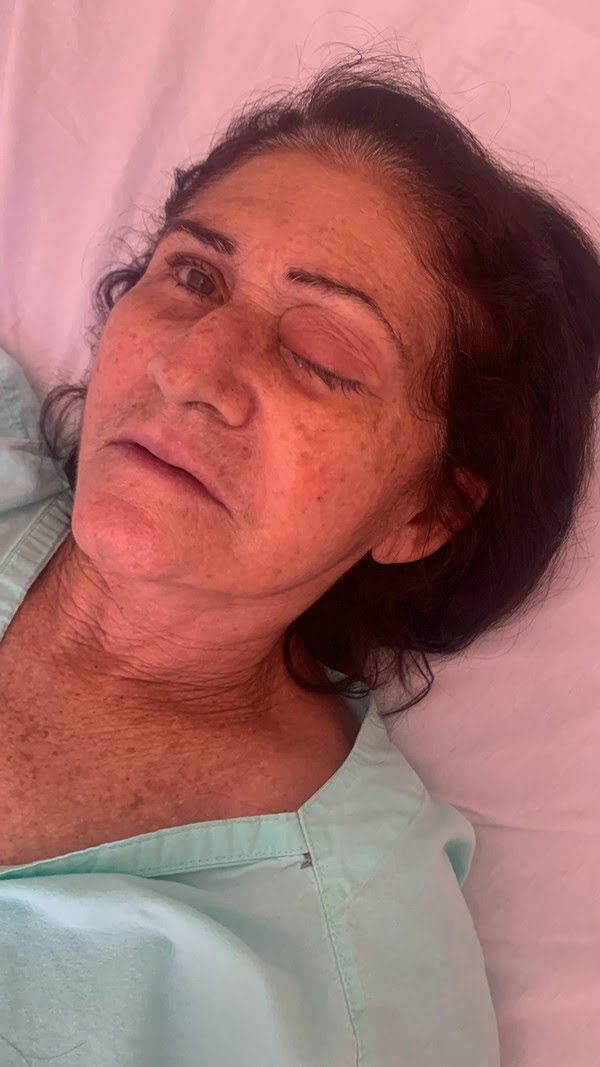 Desastre na Saúde: Mutirão de Catarata Deixa 8 Pessoas Cegas no RN e Gera Revolta!