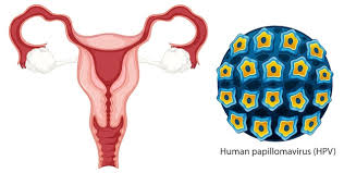 HPV: O vírus que afeta milhões e os riscos associados à falta de informação