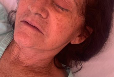 Desastre na Saúde: Mutirão de Catarata Deixa 8 Pessoas Cegas no RN e Gera Revolta!